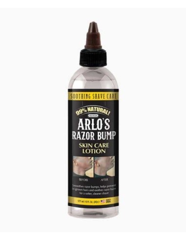Arlos Razor Bump Skin Care Lotion Arlos Razor Bump Skin Care Lotion