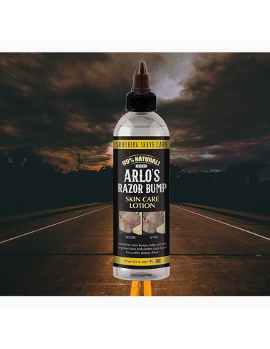 Arlos Razor Bump Skin Care Lotion Arlos Razor Bump Skin Care Lotion