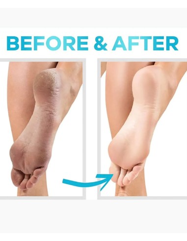 Cerave SA Renewing Foot Cream Cerave SA Renewing Foot Cream