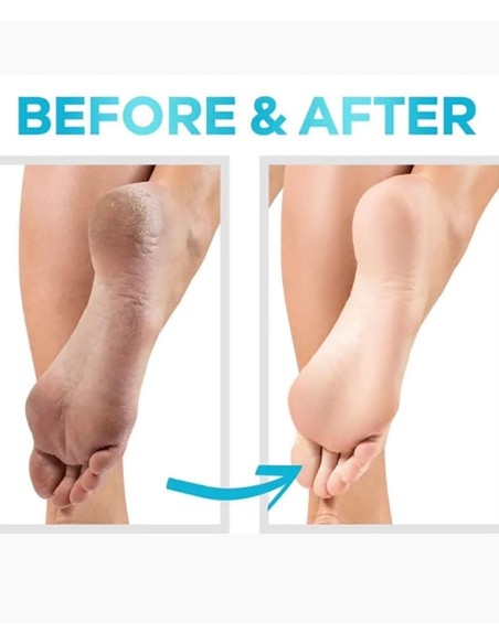 Cerave SA Renewing Foot Cream Cerave SA Renewing Foot Cream