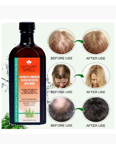 Nature Spell Authentic Jamaican Black Castor Oil With Hemp
