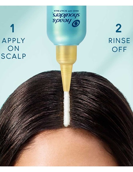 Dermax Pro Soothing Relief Aloe Rinse Off Scalp Balm Dermax Pro Soothing Relief Aloe Rinse Off Scalp Balm